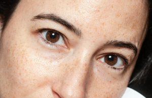 How to reduce sun damage on skin How to reduce sun damage on skin