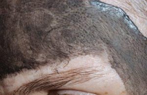 Benefits of regular facial exfoliation Benefits of regular facial exfoliation